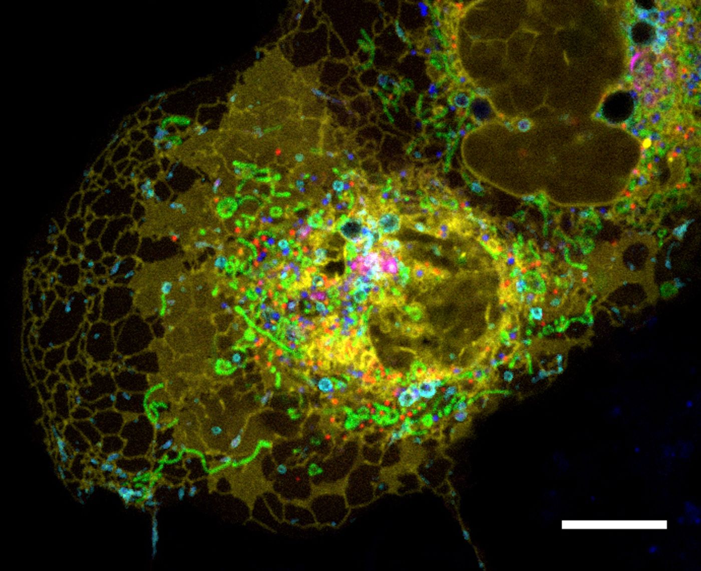 Multispectral confocal microscopy of a fibroblast cell expressing fluorescent proteins targeted to organelles: lysosomes, mitochondria, endoplastmic reticulum, peroxisomes, Golgi, and lipid droplets. Scale bar, 10 µm. / Credit: CC2.0 / NIH