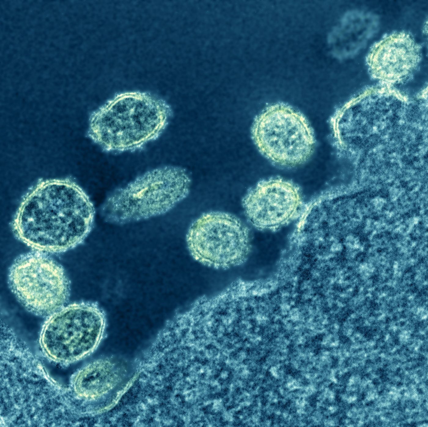 Electron micrograph of 1918 H1N1 influenza virus particles near a cell. / Credit: NIAID