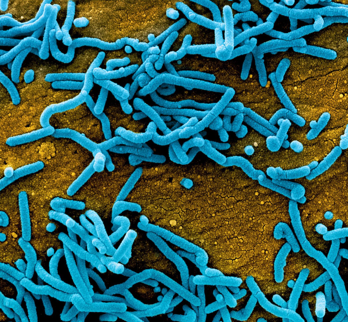   Colorized scanning electron micrograph of Marburg virus particles (blue) both budding and attached to the surface of infected VERO E6 cells (orange). Image captured and color-enhanced at the NIAID Integrated Research Facility in Fort Detrick, Maryland. Credit: NIAID   