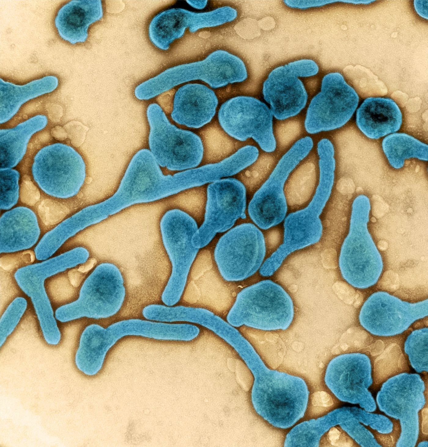 Colorized transmission electron micrograph of Marburg virus particles (blue) harvested from infected VERO E6 cell supernatant. Image captured and color-enhanced at the NIAID Integrated Research Facility in Fort Detrick, Maryland. Credit: NIAID