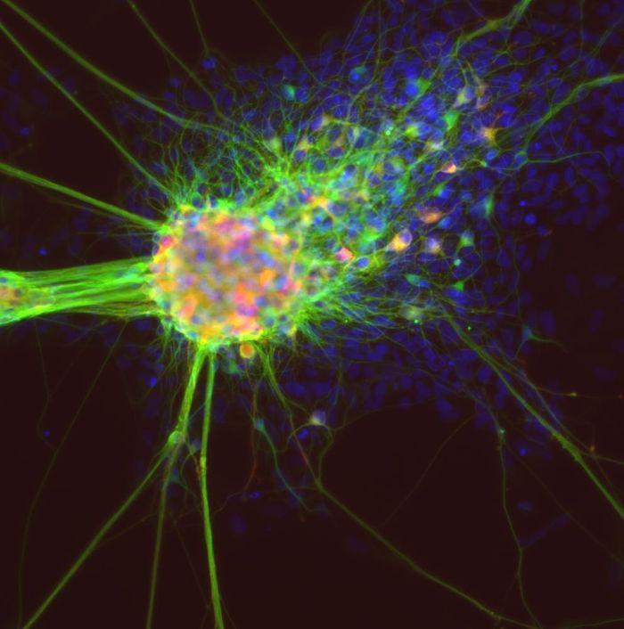 Differentiating neurons derived from induced pluripotent stem cells. / Credit: NCATS