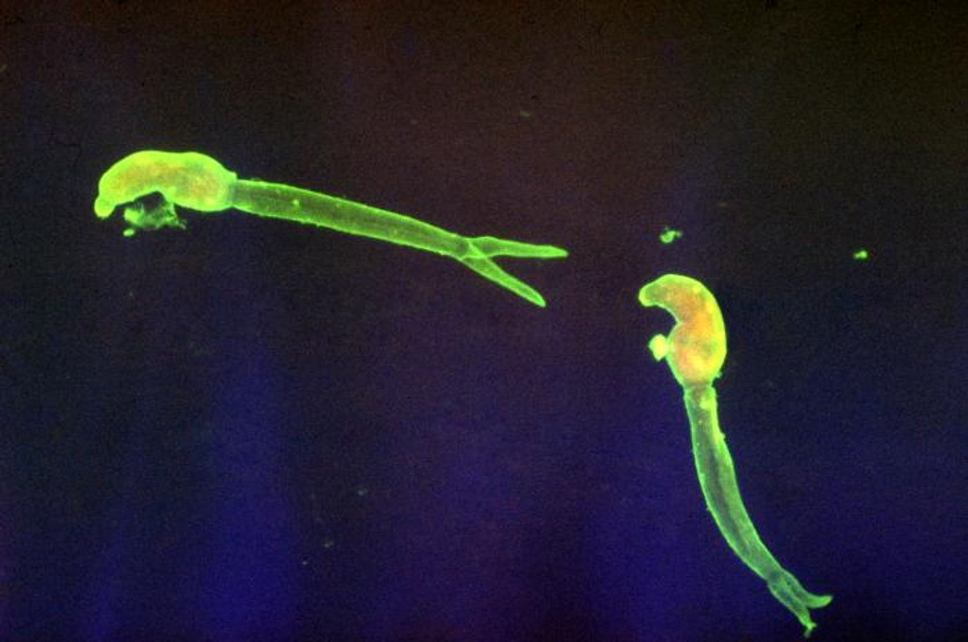 A photomicrograph of indirect fluorescent antibody staining reveals the presence of these two parasitic, Schistosoma mansoni cercariae. / Credit: CDC/ Dr. Sulzer