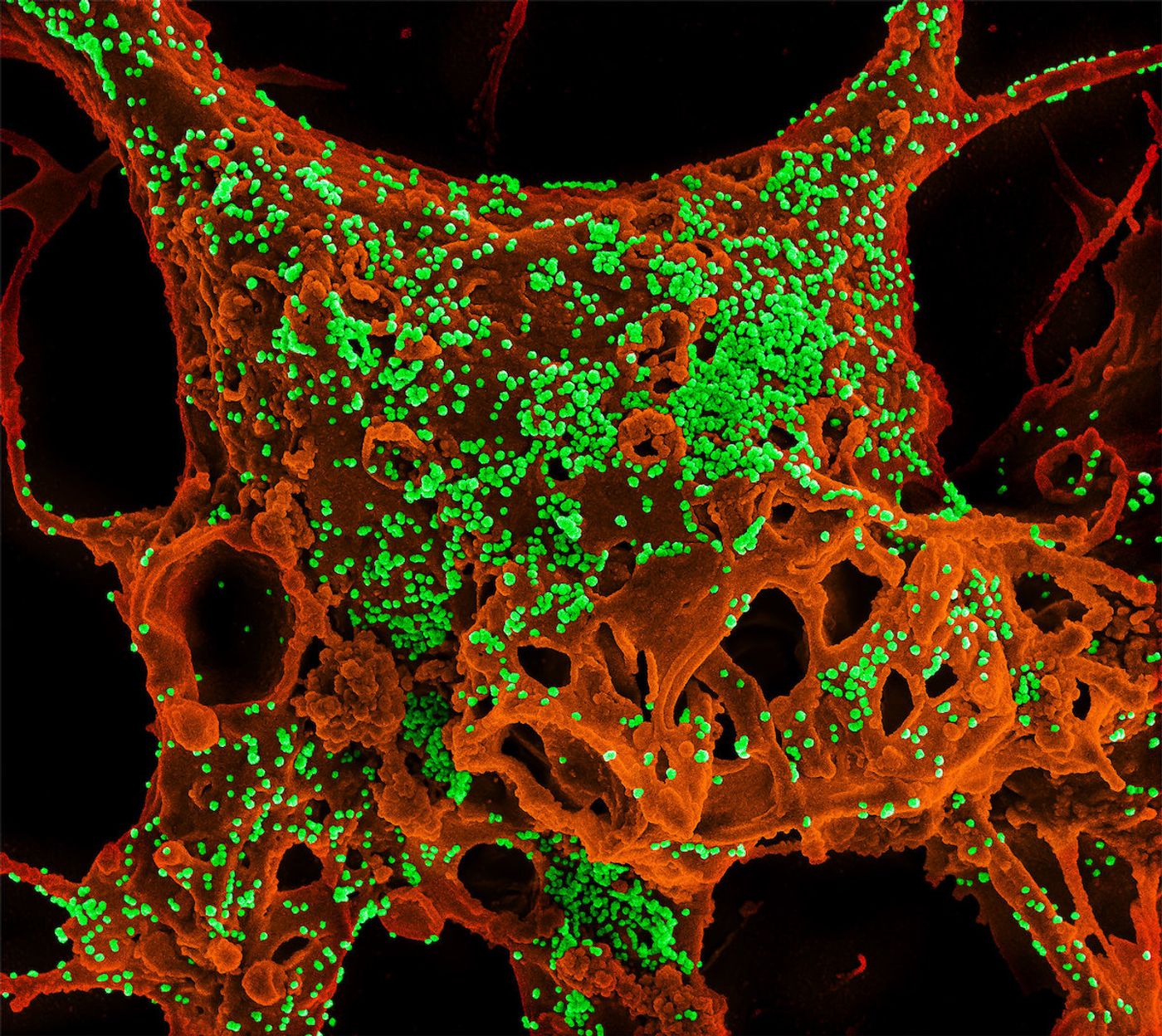 Color-enhanced scanning electron micrograph of Vero E6 cells infected with Middle East respiratory syndrome coronavirus (MERS-CoV). Image captured and color-enhanced at the NIAID Integrated Research Facility in Ft. Detrick, Maryland. Credit: NIAID