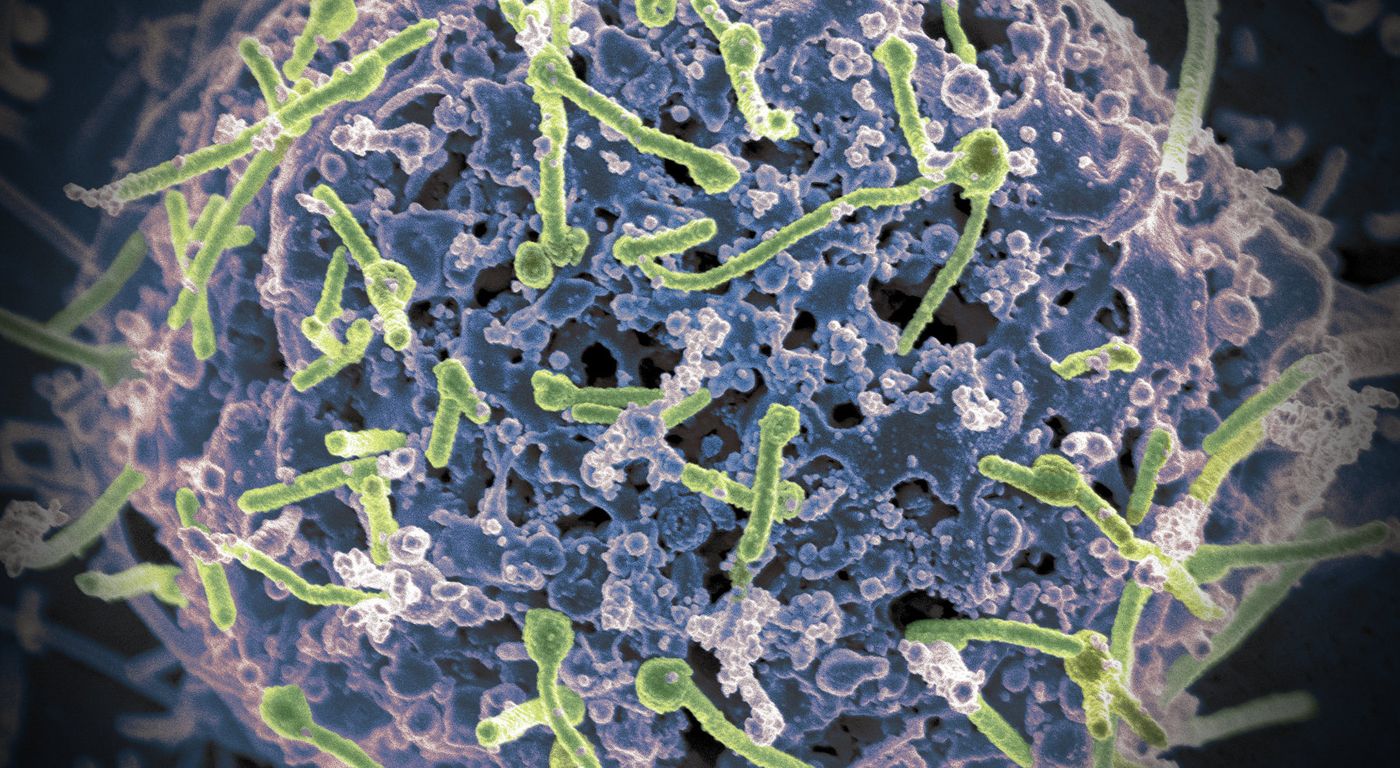 (Cropped) NIH image of the Ebola virus (green) on a cell surface. Perez-Zsolt et al Nature Genetics 2019 showed that Anti-Siglec 1 antibodies stopped cells from taking up Ebola virus. / Image credit: National Institutes of Allergy and Infectious Diseases, NIH