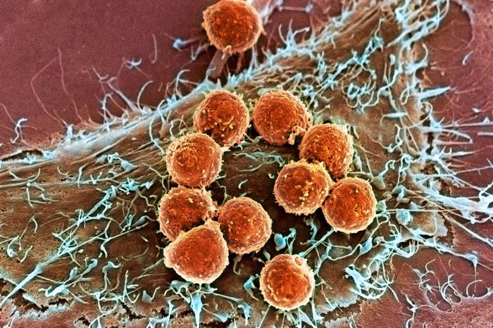 Scanning electron microscope image of immune cells attacking a cancer cell (mskcc.org)