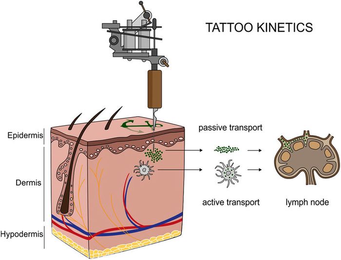 Translocation of tattoo particles from skin to lymph nodes. Upon injection of tattoo inks, particles can be either passively transported via blood and lymph fluids or phagocytized by immune cells and subsequently deposited in regional lymph nodes. After healing, particles are present in the dermis and in the sinusoids of the draining lymph nodes. The picture was drawn by the authors /Credit: Shreiver et al Scientific Reports 2017