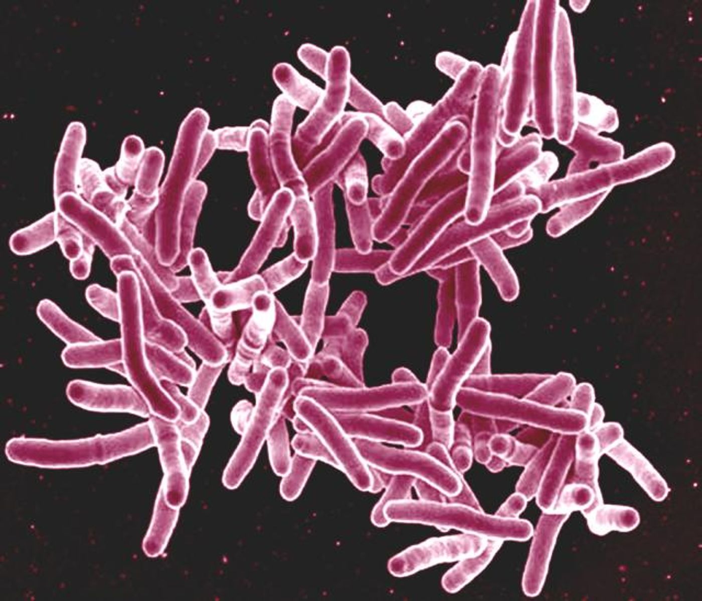 Scanning electron micrograph of Mycobacterium tuberculosis bacteria, which cause TB. / Credit: NIAID