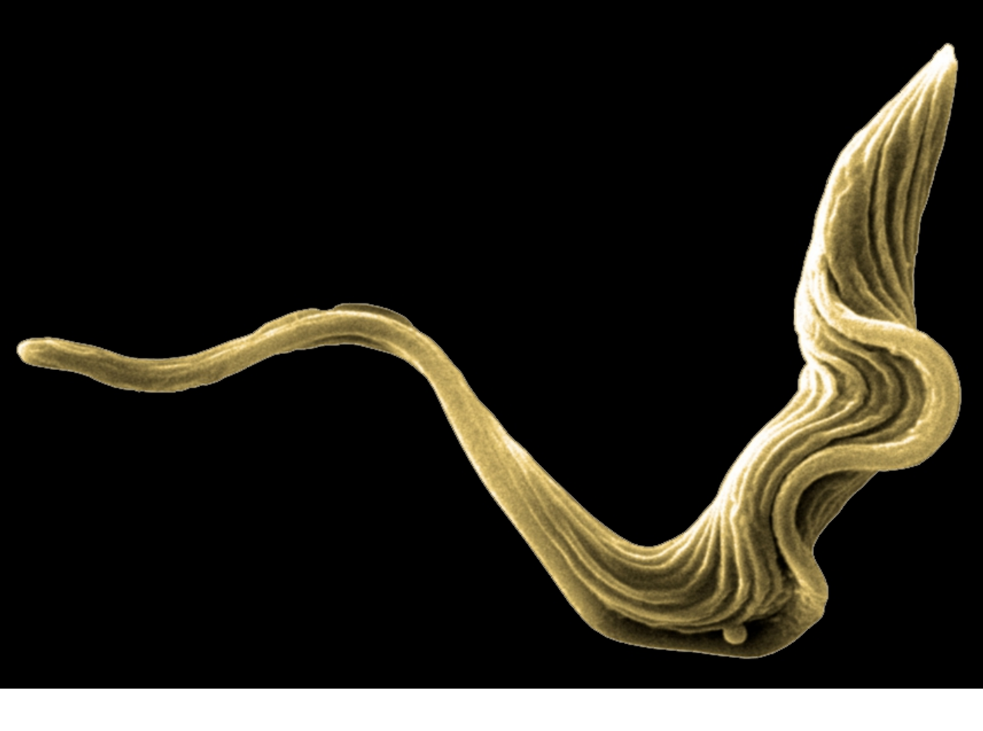 Trypanosoma brucei is a complex of protozoan parasites that cause a disease known as African sleeping sickness. 