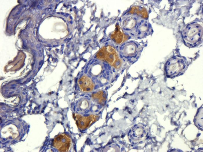 Immunohistochemical staining of paraffin embedded mouse skin tissue using anti-TGF beta 1. Source: Biorbyt