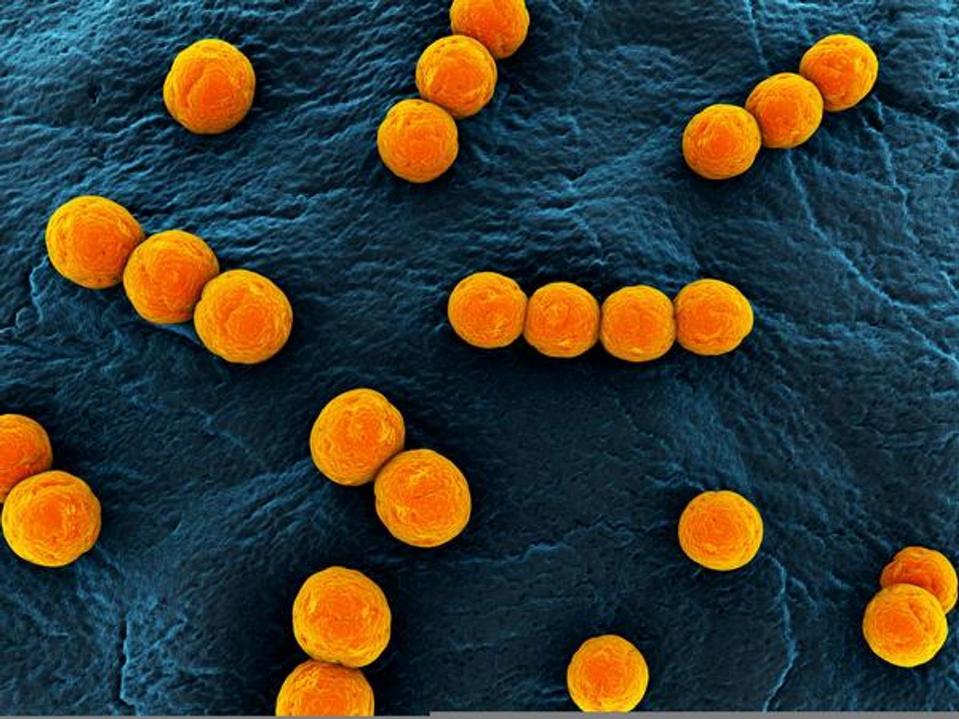 Streptococcus pyogenes may cause PANDAS