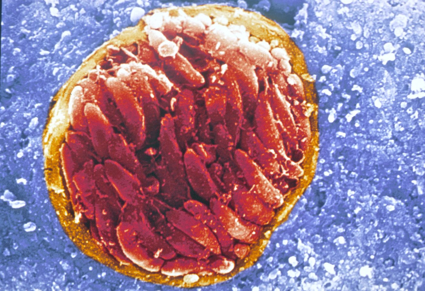 The protozoan Toxoplasma gondii, tissue cyst in brain. Source: Science Life