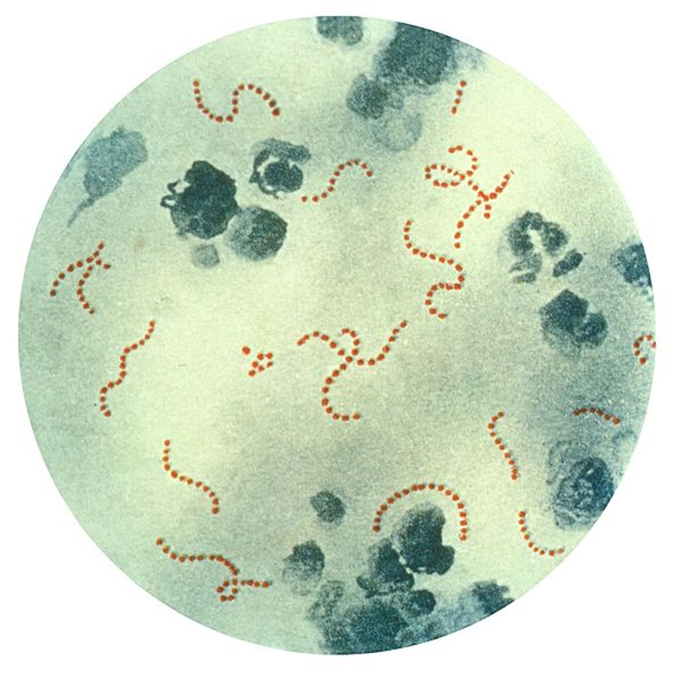 Photomicrograph of Streptococcus pyogenes bacteria / Credit: CDC