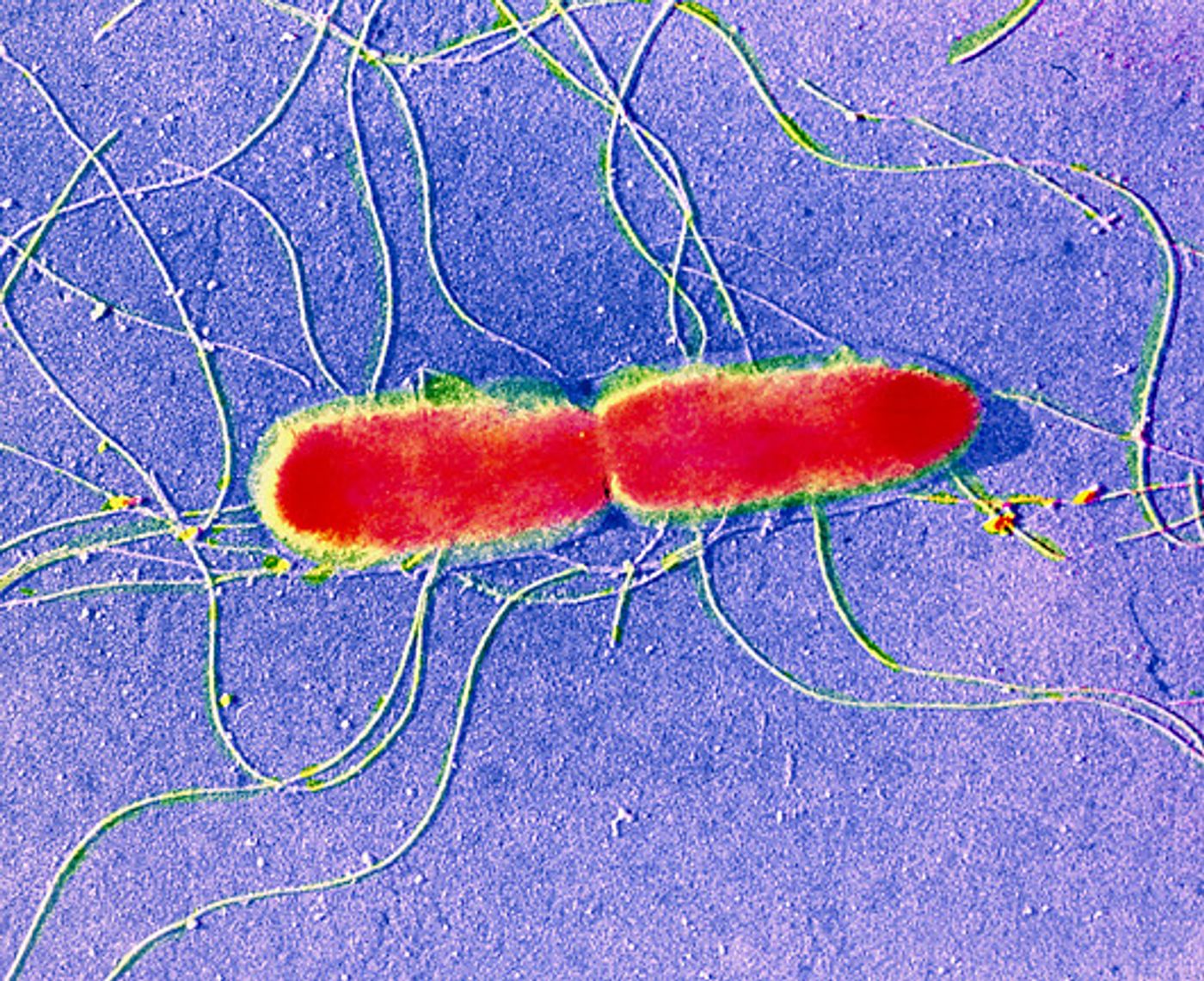 Electron micrograph of S. typhi