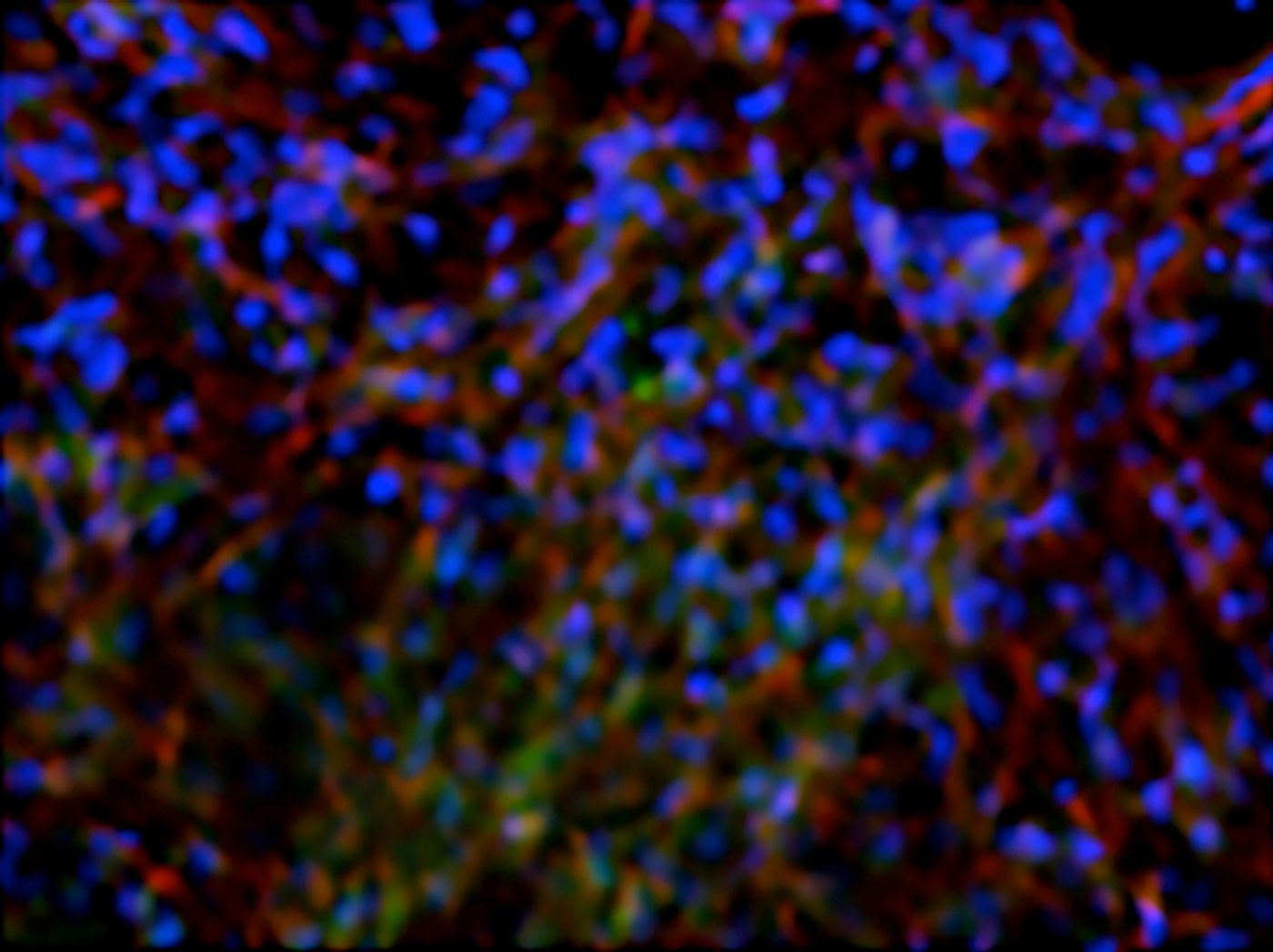 Stained image of human pluripotent stem cells cultured in adenosine to induce differentiation into functional osteoblasts. / Credit: UC San Diego
