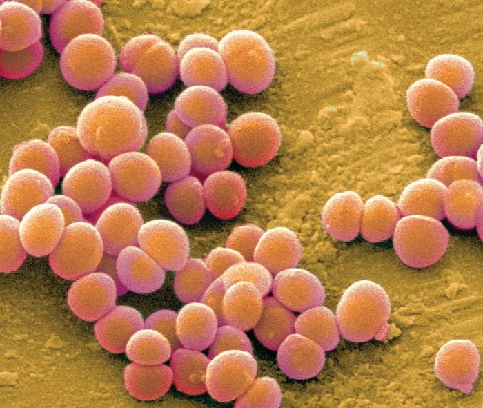 Staph Curbs Virulence To Enter Bloodstream Microbiology   EyJidWNrZXQiOiJsYWJyb290cy1hc3NldHMiLCJrZXkiOiJfcHVibGljXC9fZmlsZXNcL3N5c3RlbVwvY2tcL3RyZW5kaW5nXC91bml2IG9mIGNoaWNfYmE1YTMzNDM4YWVhY2RlMTM1MWViODNlODc4YWFlOTguanBnIiwiZWRpdHMiOnsicmVzaXplIjp7IndpZHRoIjo3MDAsImZpdCI6ImNvdmVyIn19fQ==