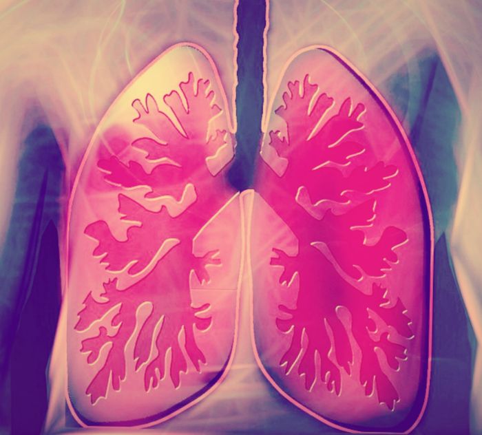 Lung illustration, credit: public domain