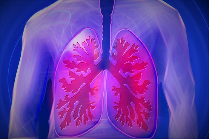 Acute lung injury kills 30 to 40 percent of those affected.