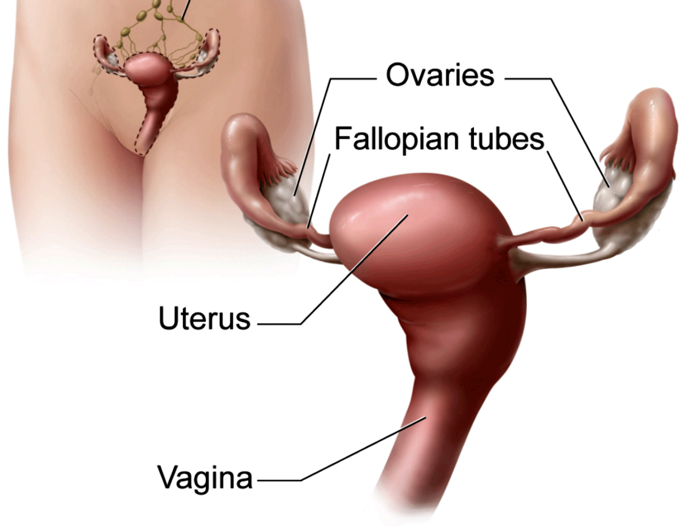 Diagram of uterus, credit: NCI