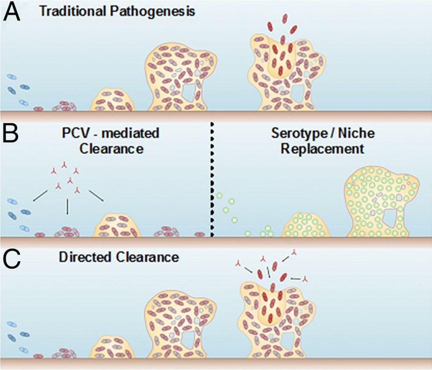 (A) S. pneumoniae grows in the nasal passages, producing a bacterial biofilm that provides protection. External triggers like viral infection prompt the active release of virulent pneumococci that disseminate and cause disease. (B) Leading vaccination strategies [polysaccharide conjugate vaccines] mediate protection against some bacterial serotypes by clearing pneumococci before biofilm establishment. But clearing all bacteria opens vulnerabilities to colonization by nonvaccine serotypes or other bacterial species. (C) The strategy featured in this work mediates clearance of only virulent biofilm-released bacteria while keeping the presence of the preexisting biofilm. Source: PNAS