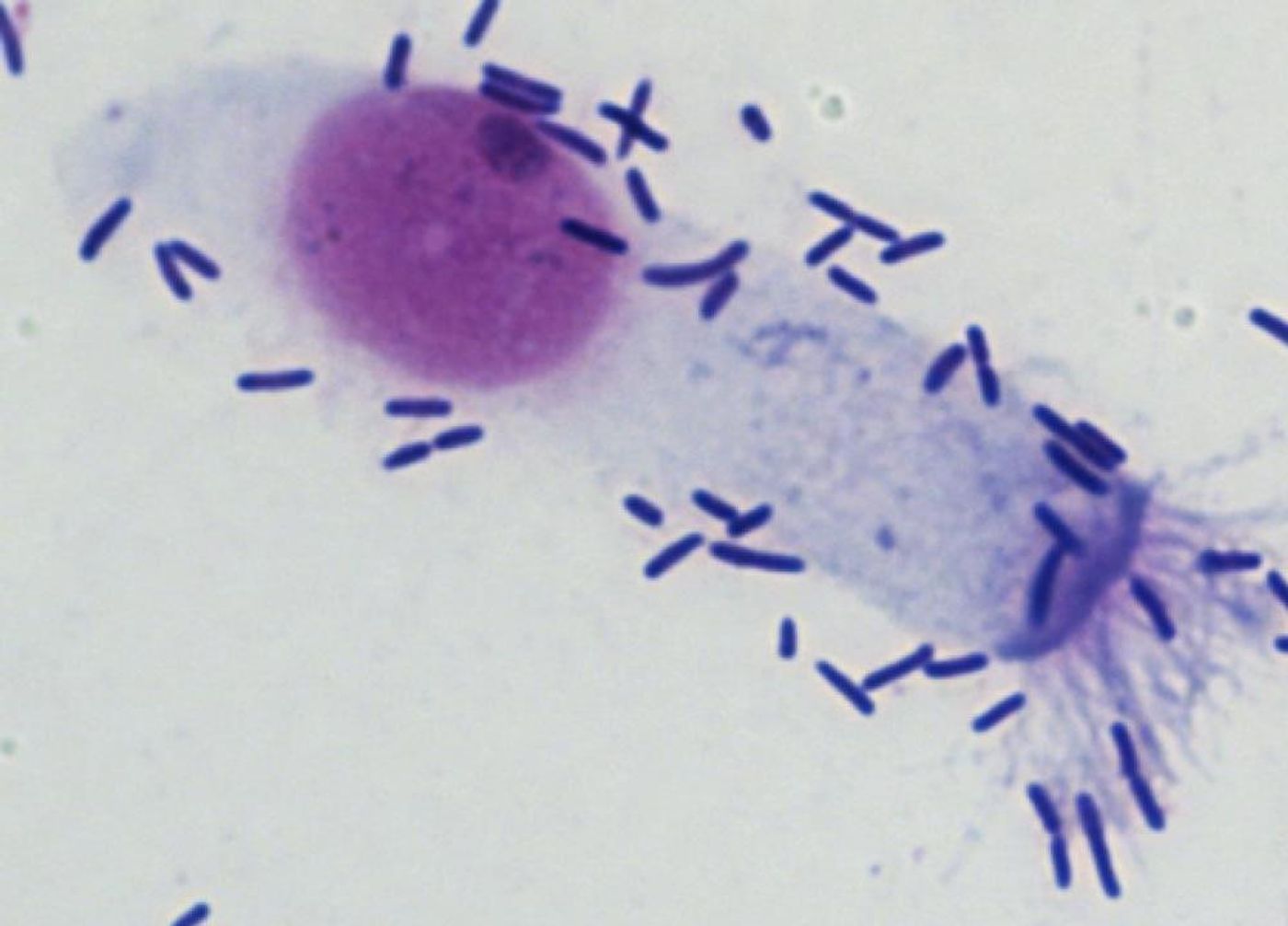 This is pneumococci sticking to a nasal cells. / Credit: Queen Mary University of London