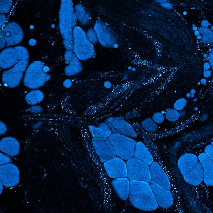 A constellation of vesicles, tiny cellular transport packages seen here as blue dots, are released by cancer cells into the surrounding tissue. Illinois researchers found that these vesicles, coupled with molecular changes in metabolism, can signal big changes in the tissue around tumors. / Credit: Image courtesy of Stephen Boppart and Haohua Tu University of Illinois
