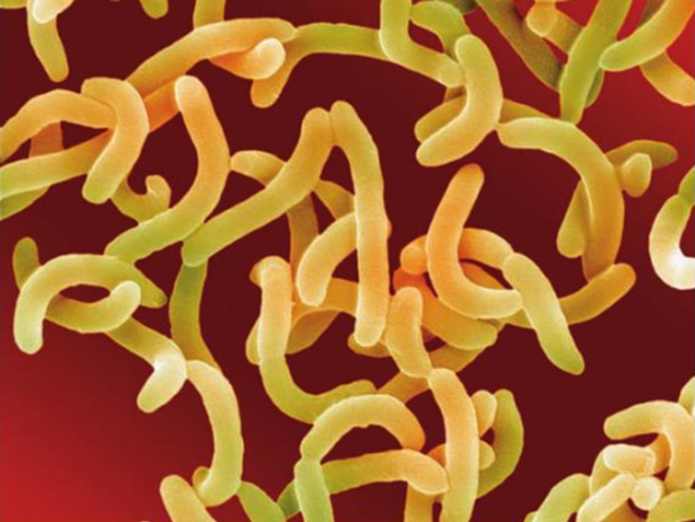 Vibrio cholerae causes cholera.