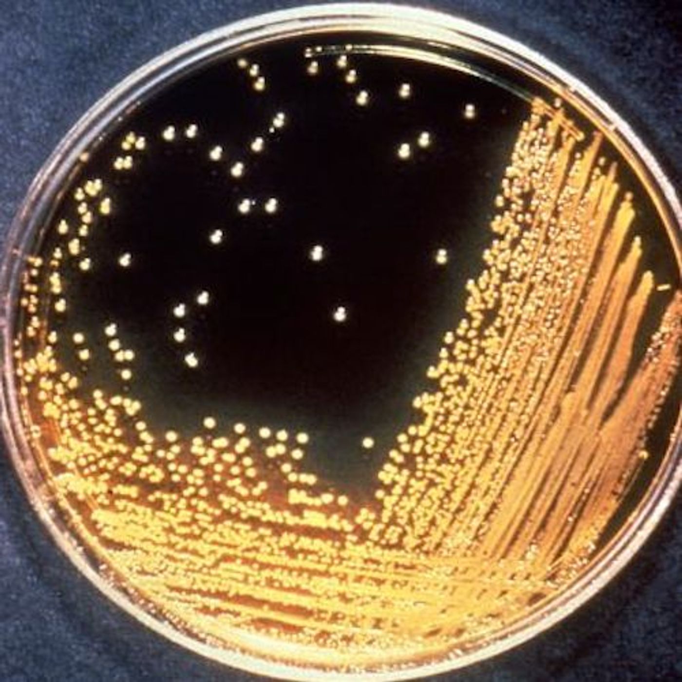 Vibrio choelrae grows in a dish / Image credit: Pixnio