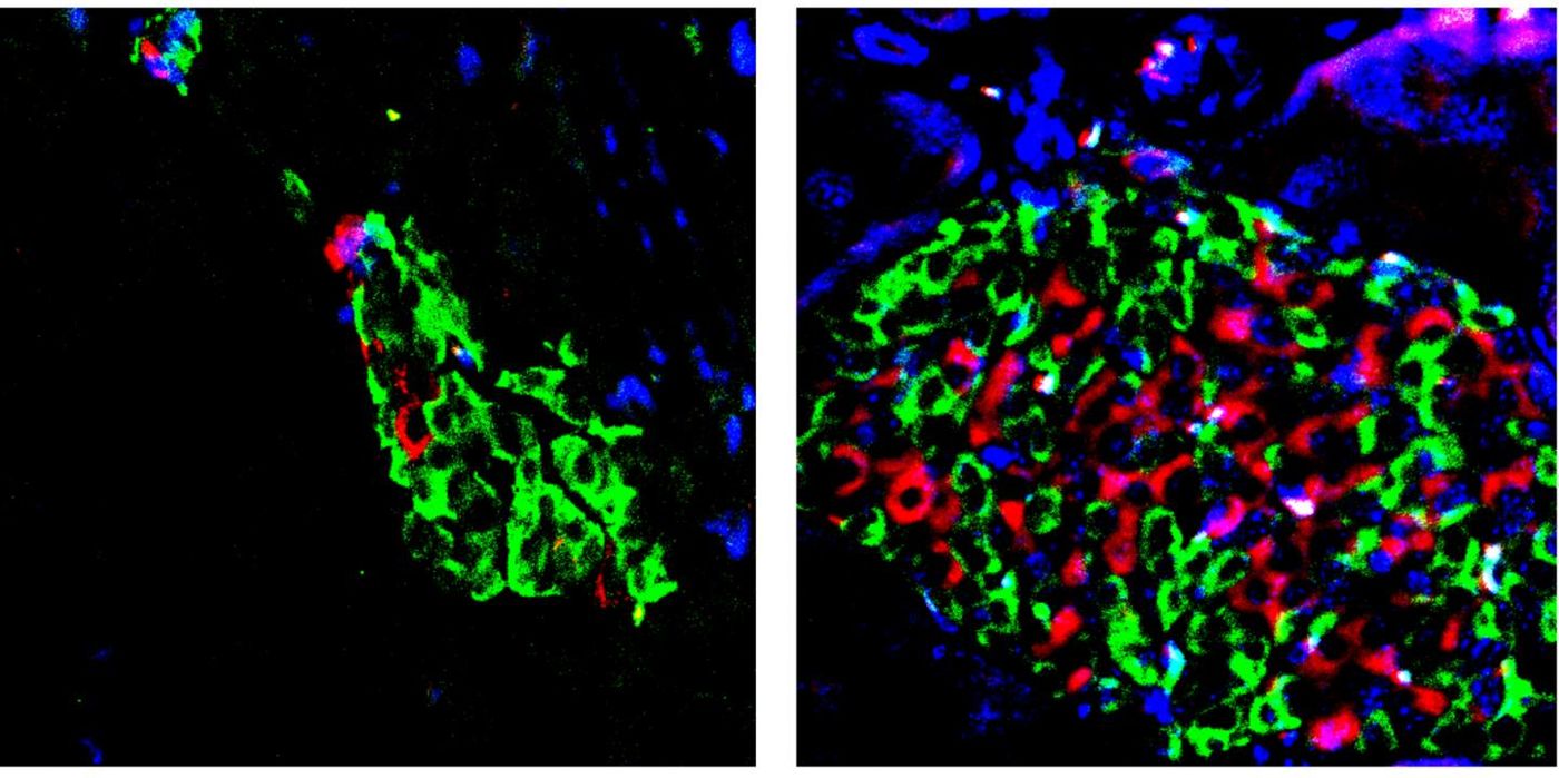 Enhanced activation of vitamin D curbs type 2 diabetes progression in animal models. Left: damaged insulin positive B cells (red) in a diabetic mouse pancreas. Right: B cells (red) were protected in a diabetic mouse pancreas treated with a combination of a vitamin D activator and BRD9 inhibitor. / Credit: Salk Institute