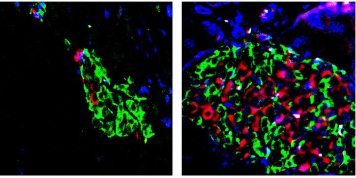 Enhanced activation of vitamin D curbs type 2 diabetes progression in animal models. Left: damaged insulin positive B cells (red) in a diabetic mouse pancreas. Right: B cells (red) were protected in a diabetic mouse pancreas treated with a combination of a vitamin D activator and BRD9 inhibitor. / Credit: Salk Institute
