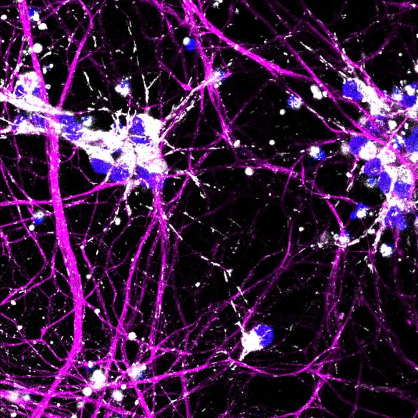 Purple neurons with mitochondria / Credit: Melanie Leboeuf