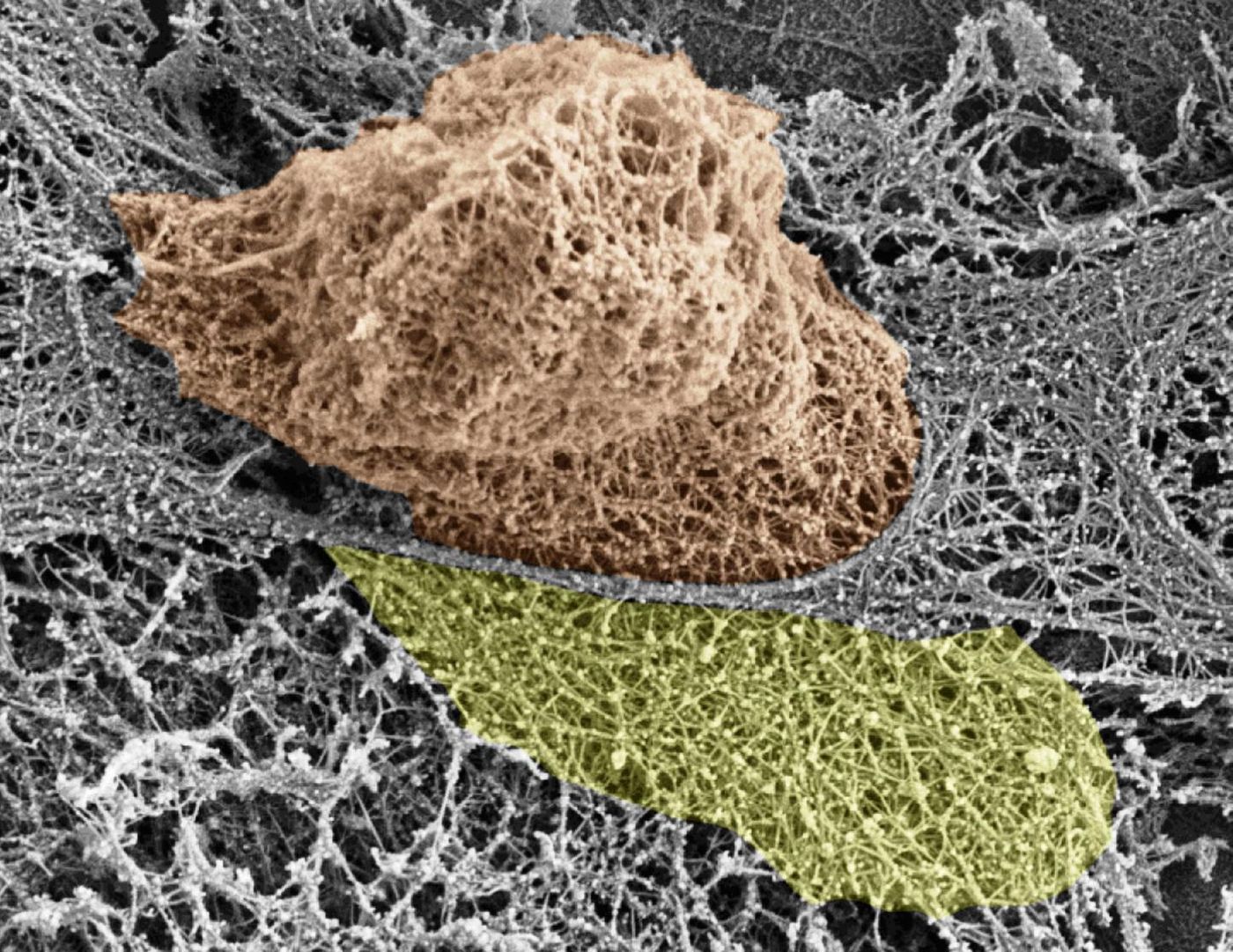 A T Cell squeezing through a blood vessel wall. Credit: Barzilai et al./Cell Reports 2016