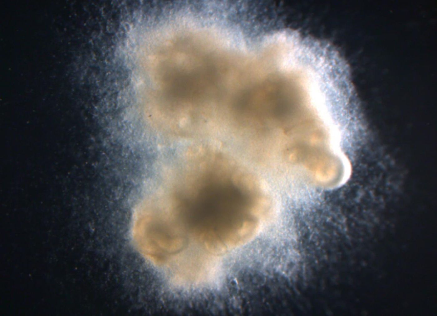 Human intestinal organoids with enteric (intestinal) nerves generated in a petri dish using human pluripotent stem cells, which can become any cell type in the body. / Credit: Cincinnati Children's