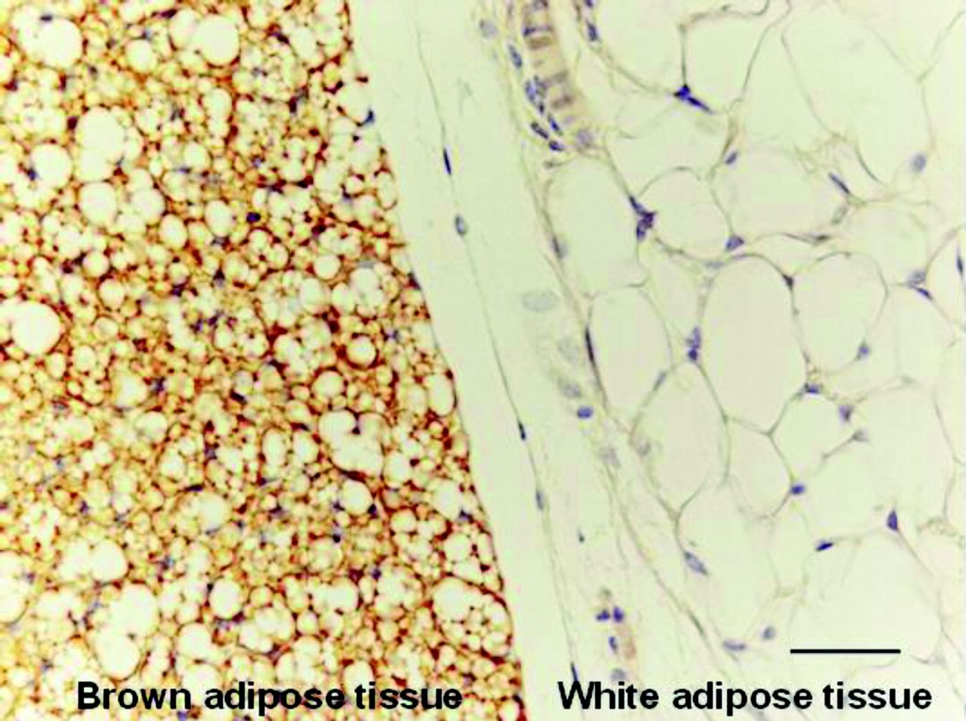 The difference between brown and white fat cells. Credit: Susan Ardizzoni.