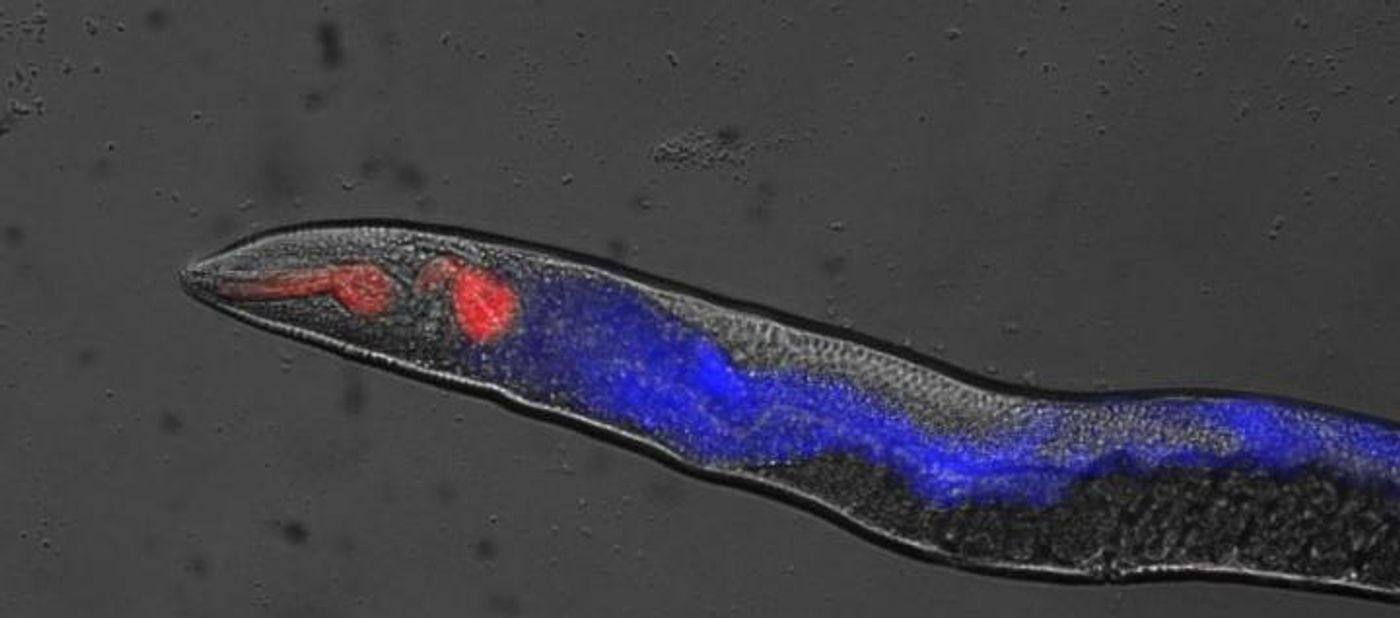 This is cellular necrosis in C. elegans. / Credit: David Gems, UCL