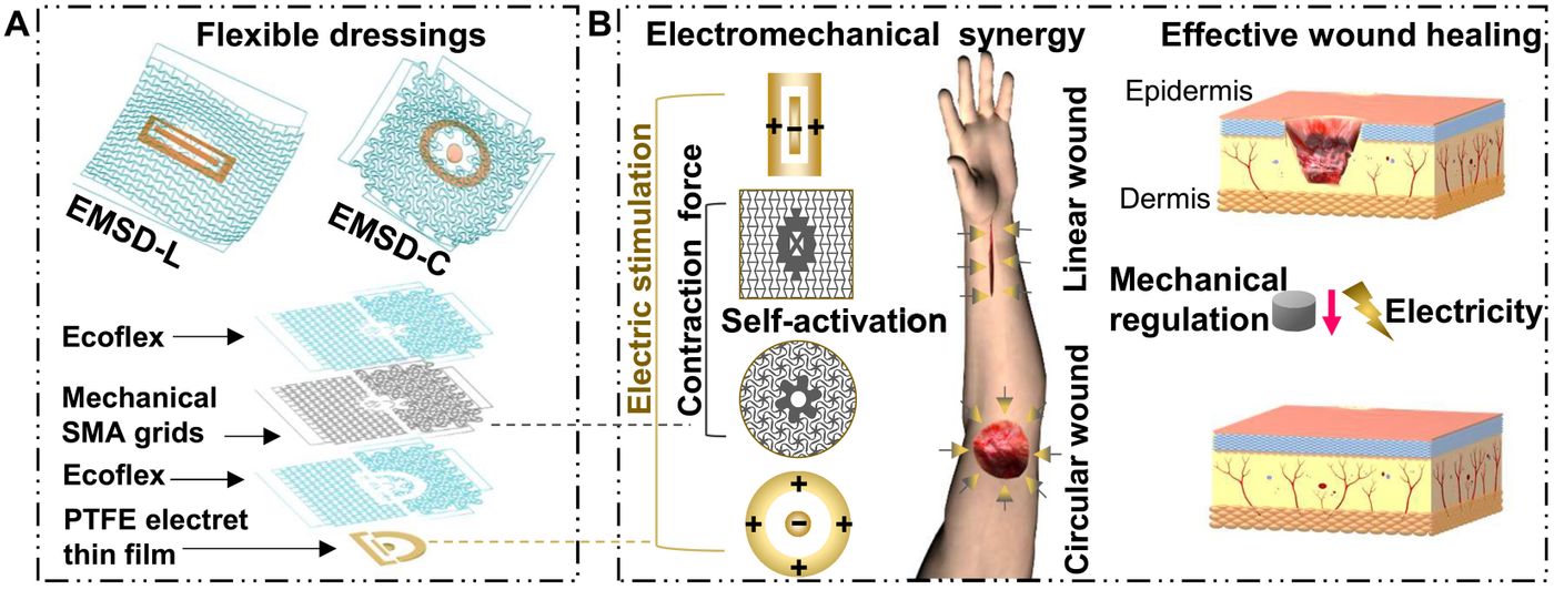 Reprinted with permission from:  et. al. A programmable and skin temperature-activated electromechanical synergistic dressing for effective wound healing. Science Advances, 2022 DOI: 10.1126/sciadv.abl8379. Copyright 2022 Science Advances.