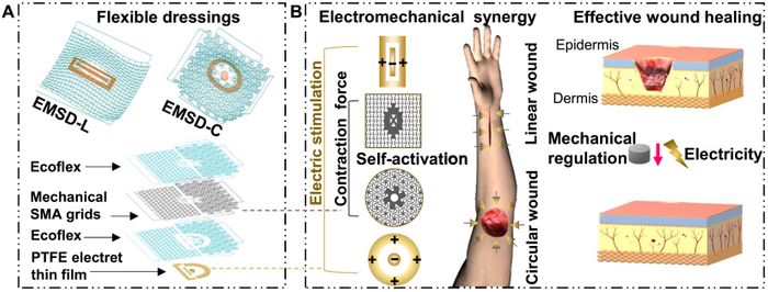 Reprinted with permission from:  et. al. A programmable and skin temperature-activated electromechanical synergistic dressing for effective wound healing. Science Advances, 2022 DOI: 10.1126/sciadv.abl8379. Copyright 2022 Science Advances.