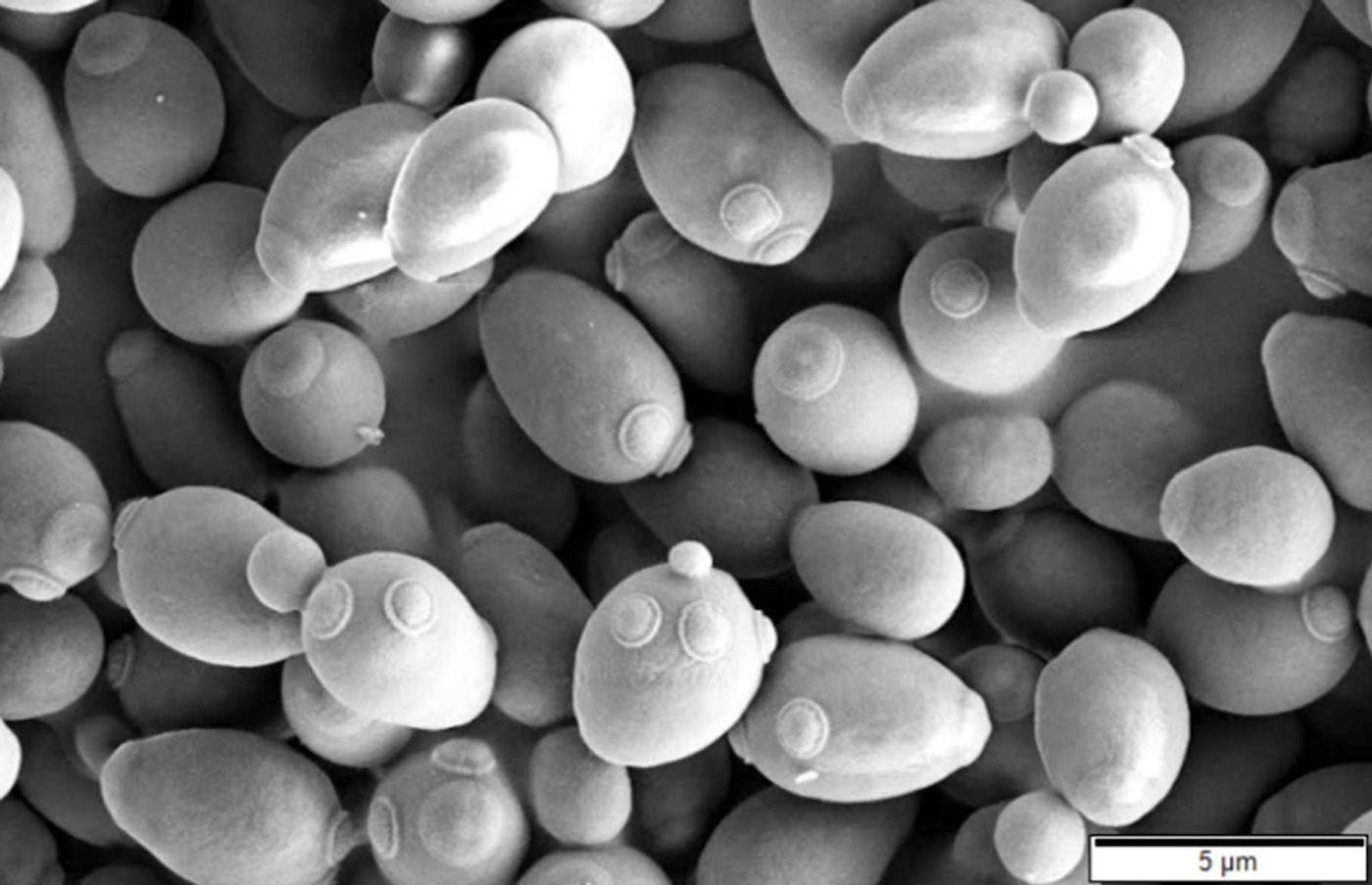  The yeast Saccharomyces cerevisiae, also known as baker's yeast, can trigger altered immune responses in Crohn's disease, according to new findings from the research team at the Cluster of Excellence PMI. Credit: © CC BY-SA 3.0 