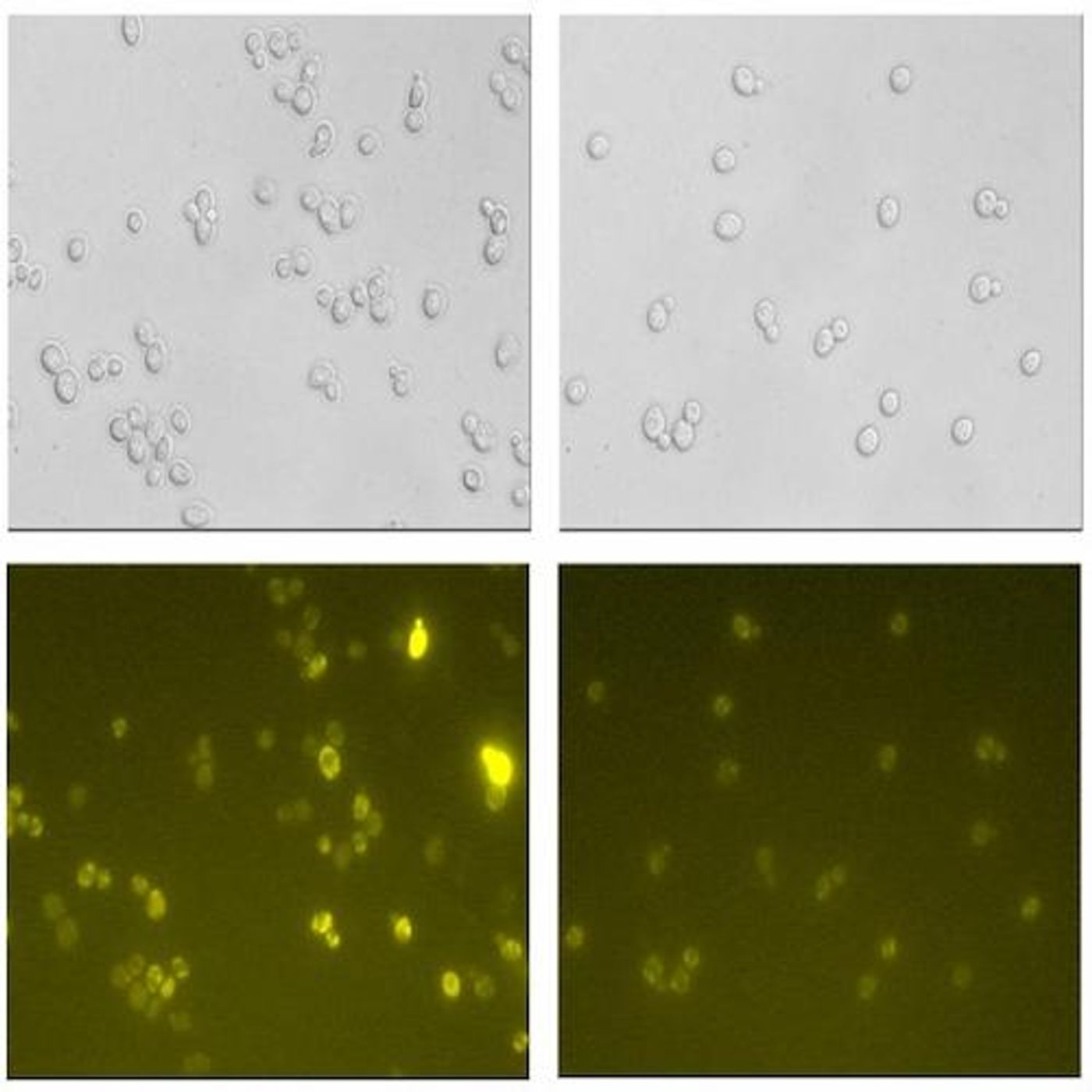 In regular yeast (the left-hand images), the secretion of proteins is hampered by harmful reactive oxygen species (ROS) generated by the yeast. The lower image shows these as fluorescent areas, which indicate cell damage. In the modified yeast (right) protein production is improved. / Credit: Mingtao Huang/Chalmers