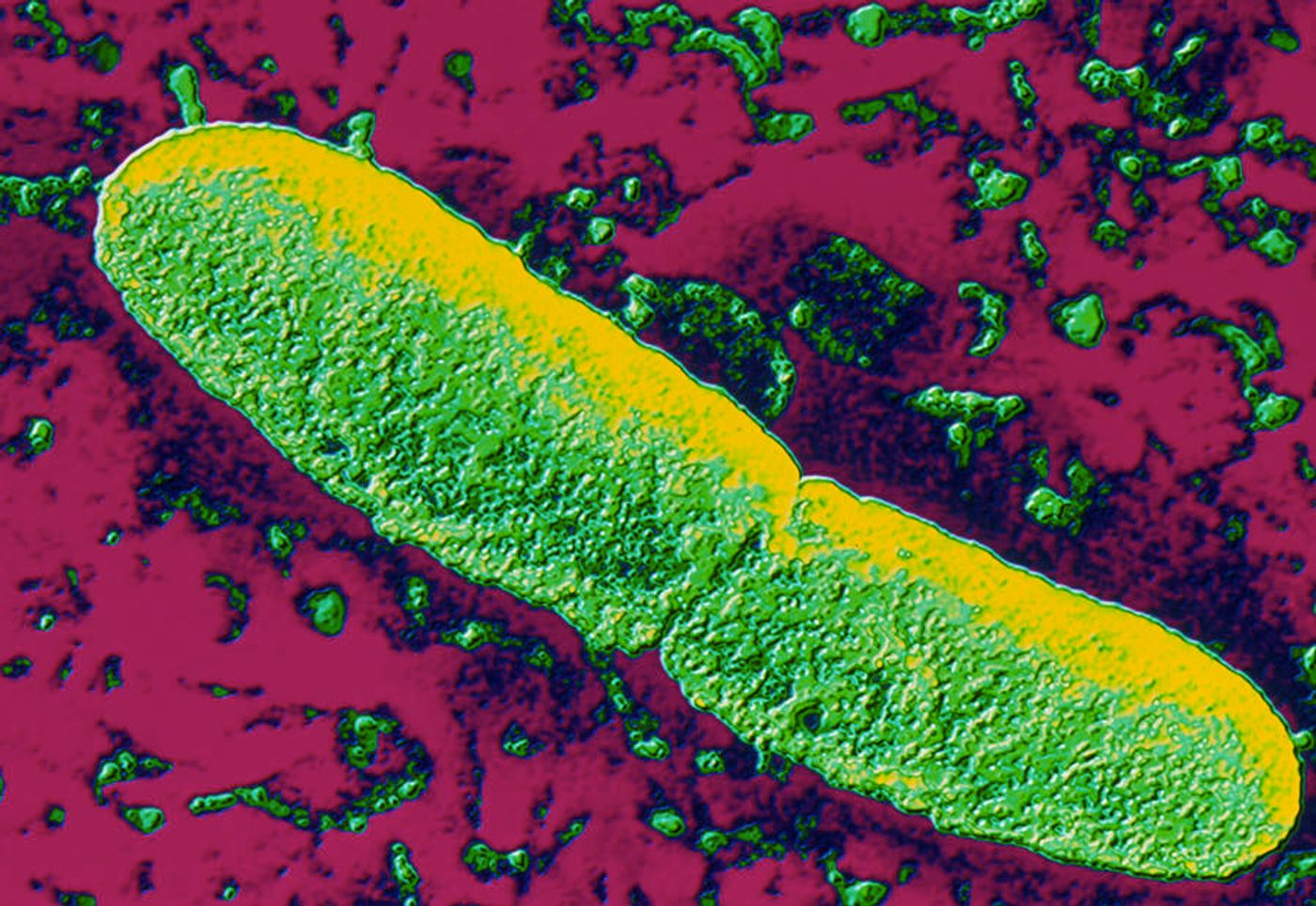 Возбудитель чумы. Чума возбудитель (Yersinia pestis). Бактерия Yersinia pestis возбудитель. Чумная палочка ( иерсиния).