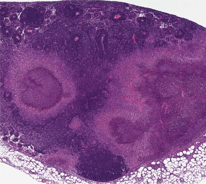 Mice infected with the bacteria Yersinia pseudotuberculosis form granulomas -- structures that confine pathogens. But those with a mutant form of the RIPK1 enzyme, rendering cells unable to undergo a particular form of cell death called apoptosis, do not. Researchers believe this RIPK1-induced apoptosis is a strategy that helps dying cells alert their neighbors that an infection is present. / Credit: University of Pennsylvania