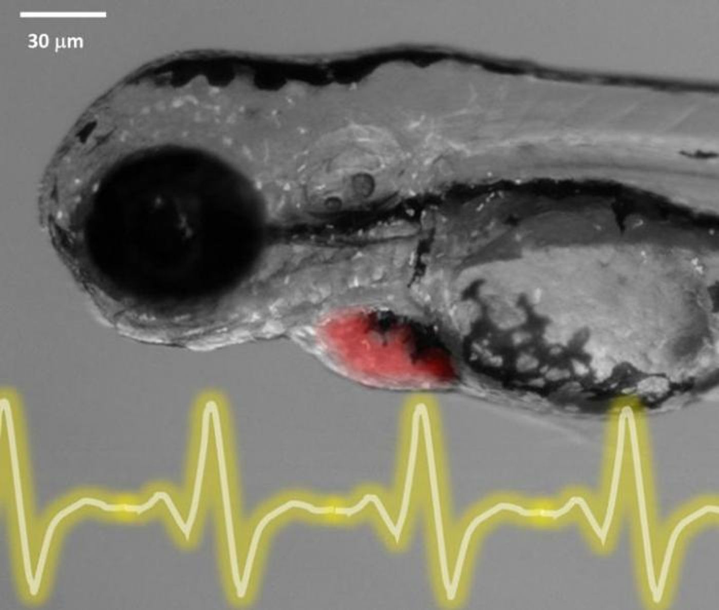 Zebrafish embryo ECG 3 days post-fertilization