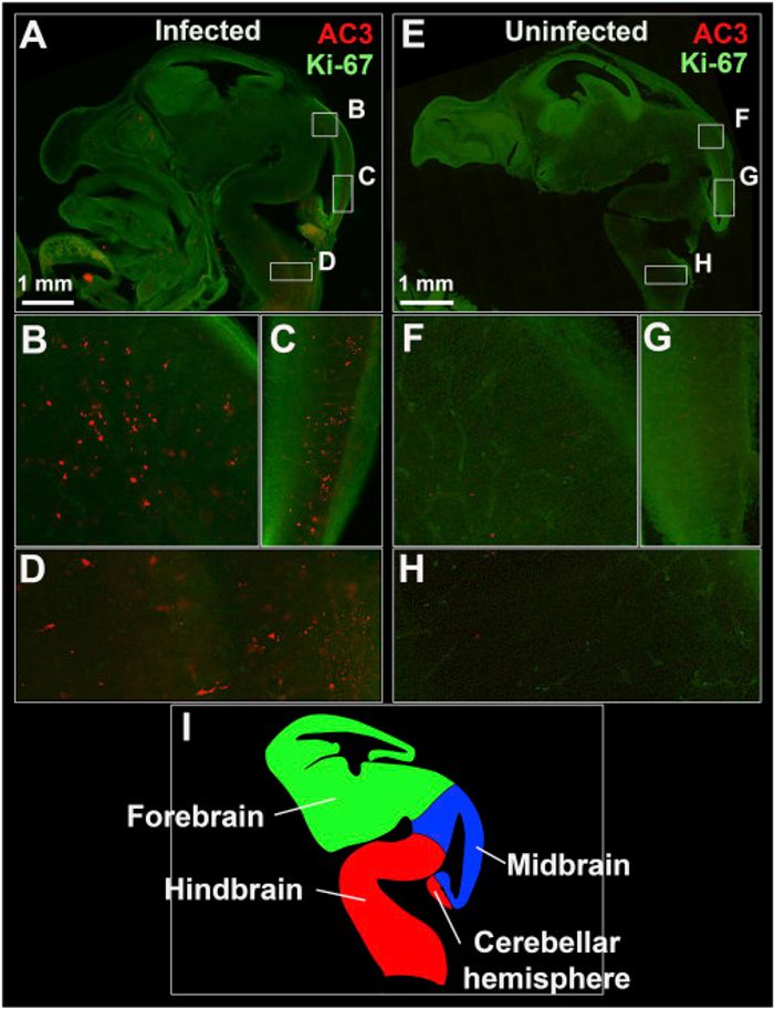 ZIKV Infection Is Associated with Evidence of Apoptosis in the Fetal Brain - (A, E) Sagittal images of representative infected (A) and uninfected (E) fetal heads showing high proliferation. (B-H) Lettered box regions (B-D and F-H) are magnified in corresponding panels below. Higher levels of apoptosis (red dots) can be seen in the midbrain (B-C) and hindbrain (D) of the infected Ifnar1+/? fetus. Alternatively, low levels of physiological apoptosis are seen in the absence of infection (F-H). (I) Diagram depicting the developing E13.5 fetal brain in sagittal view.
