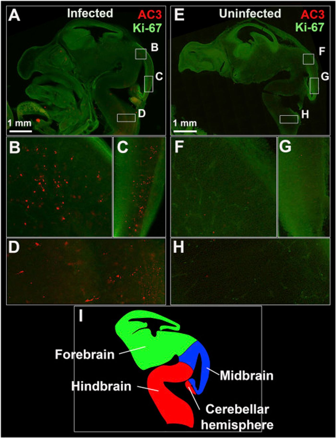 ZIKV Infection Is Associated with Evidence of Apoptosis in the Fetal Brain - (A, E) Sagittal images of representative infected (A) and uninfected (E) fetal heads showing high proliferation. (B-H) Lettered box regions (B-D and F-H) are magnified in corresponding panels below. Higher levels of apoptosis (red dots) can be seen in the midbrain (B-C) and hindbrain (D) of the infected Ifnar1+/? fetus. Alternatively, low levels of physiological apoptosis are seen in the absence of infection (F-H). (I) Diagram depicting the developing E13.5 fetal brain in sagittal view.