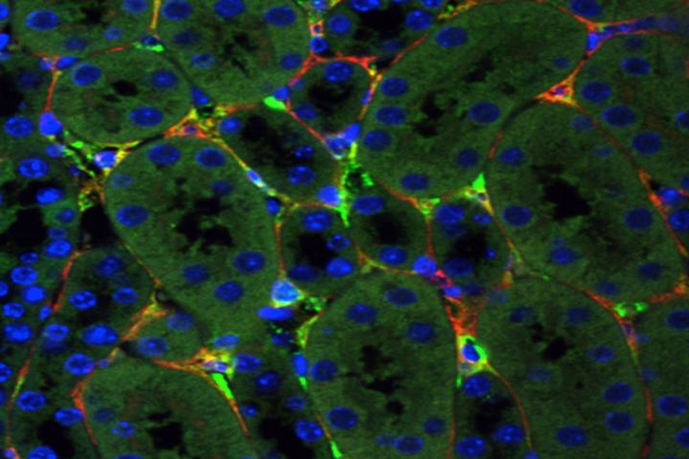 In this slide, bright green depicts genetic material delivered by a synthetic virus to mouse kidney cells, while the red stain shows cells that cause chronic kidney disease. / Credit: YOICHIRO IKEDA/Washington University