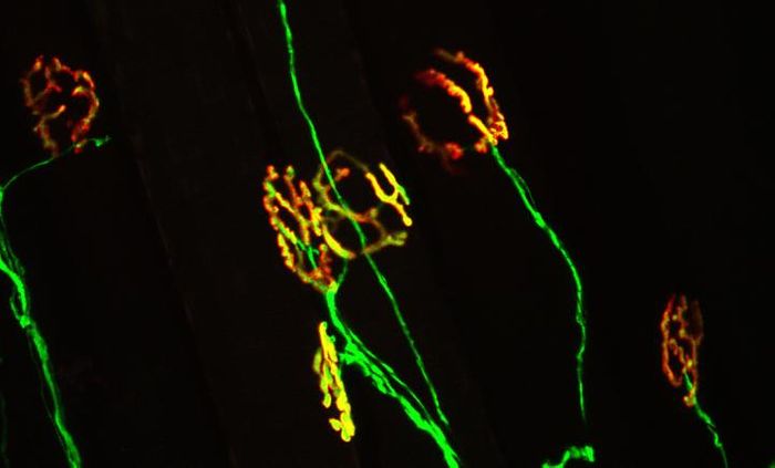 A healthy neuromuscular junction (yellow) is characterized by perfect apposition between the motor neuron (green) and nicotinic acetylcholine receptors on the muscle (red). This synapse is damaged early in ALS, a change believed to contribute the onset and progression of the disease. / Credit: Virginia Tech Carilion Research Institute