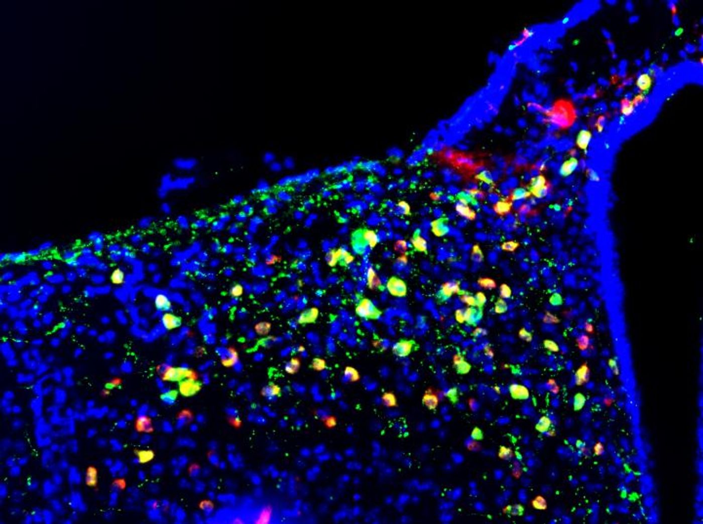 This is a fluorescence microscopy image of the hypothalamus arcuate nucleus with POMC neurons in green. / Credit: Alicia G Gómez-Valadés