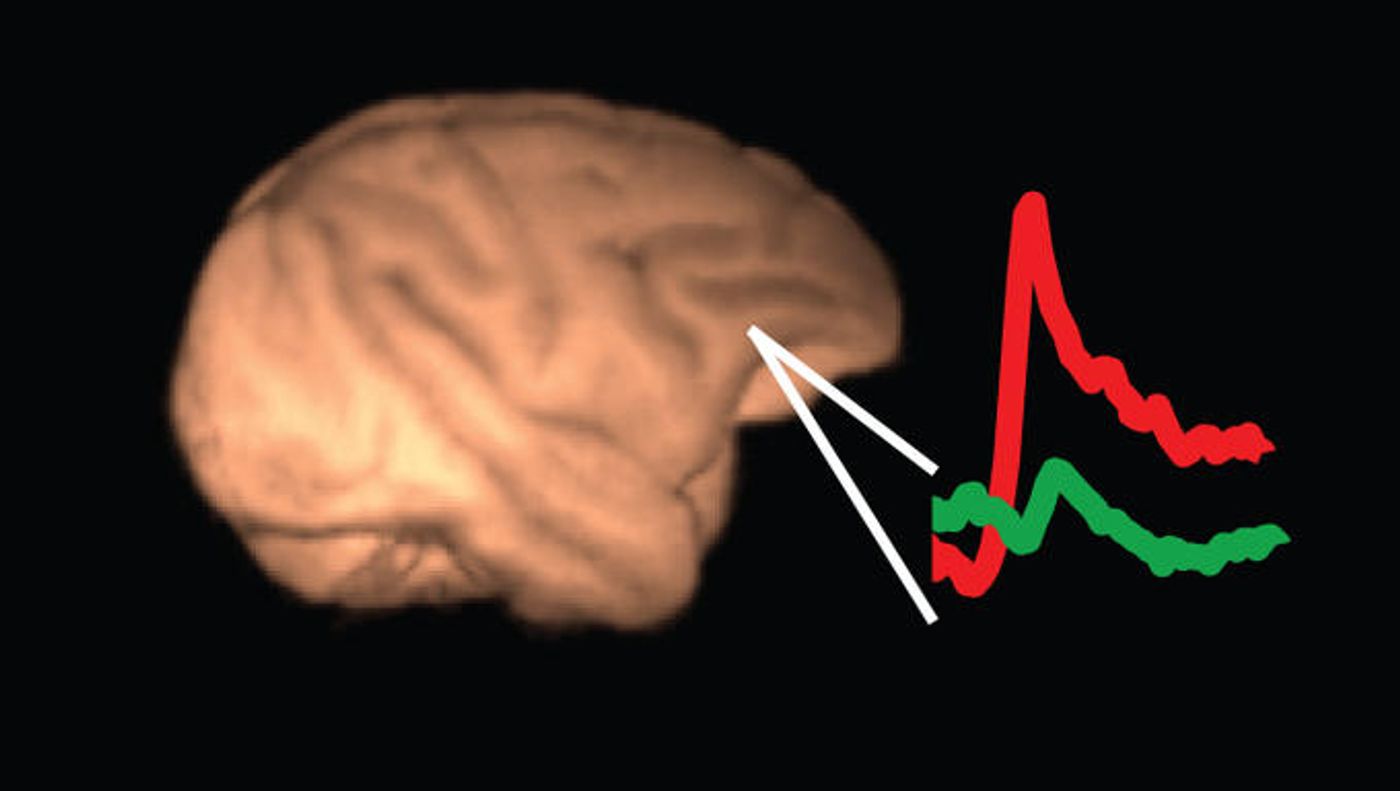 Amyloid PET imaging boosts early detection of Alzheimer's disease.