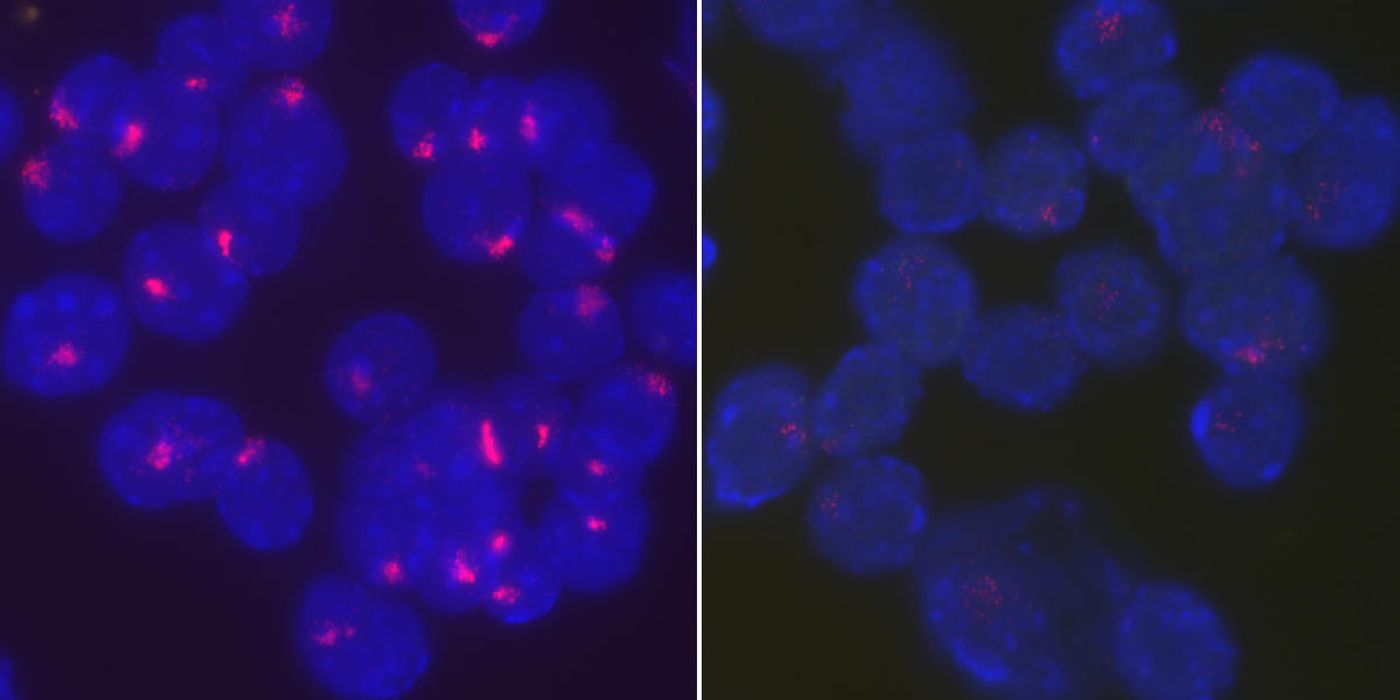Researchers found that the protein YY1 brings Xist RNA back to the inactive X chromosome to maintain X chromosome inactivation in stimulated B cells. Activated, wild type B cells from female mice tightly localize Xist RNA at their inactive X chromosomes (left), whereas Xist RNA becomes dispersed throughout the entire nucleus when YY1 is deleted (right). Source: University of Pennsylvania