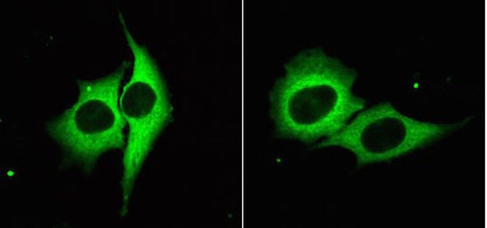 Glowing cells express GFP, which scientists used along with gene-editing techniques to uncover a new microRNA mechanism. / Credit: UT Southwestern Medical Center