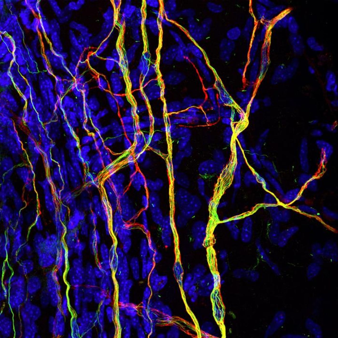 Nerve endings in the cornea, which is very sensitive to touch, have microtubules modified by Atat1 (yellow). / Credit: Laura Castaldi/EMBL